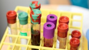 New Lab Test Panel Tracks Health and Deficiencies in Vegan Blood